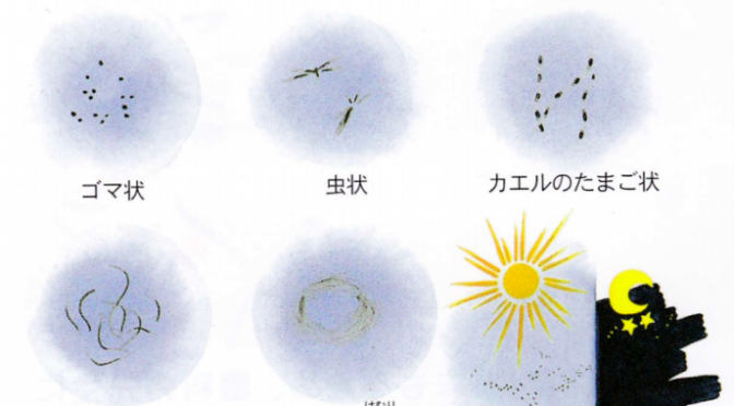 2016-04-11 飛蚊症 見え方