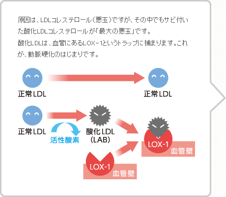 動脈硬化の原因を知ろう2